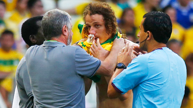 Bóng đá - David Luiz phải đeo mặt nạ