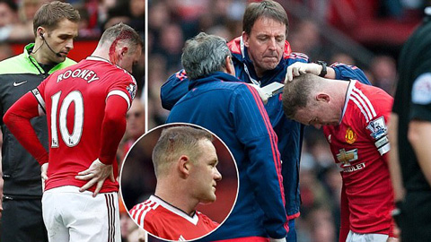 Bác sĩ M.U vá sống vết thương trong nháy mắt cho Rooney