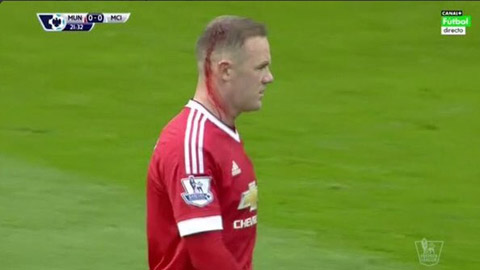Rooney chảy nhiều máu ở đầu